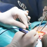 doctors performing surgery